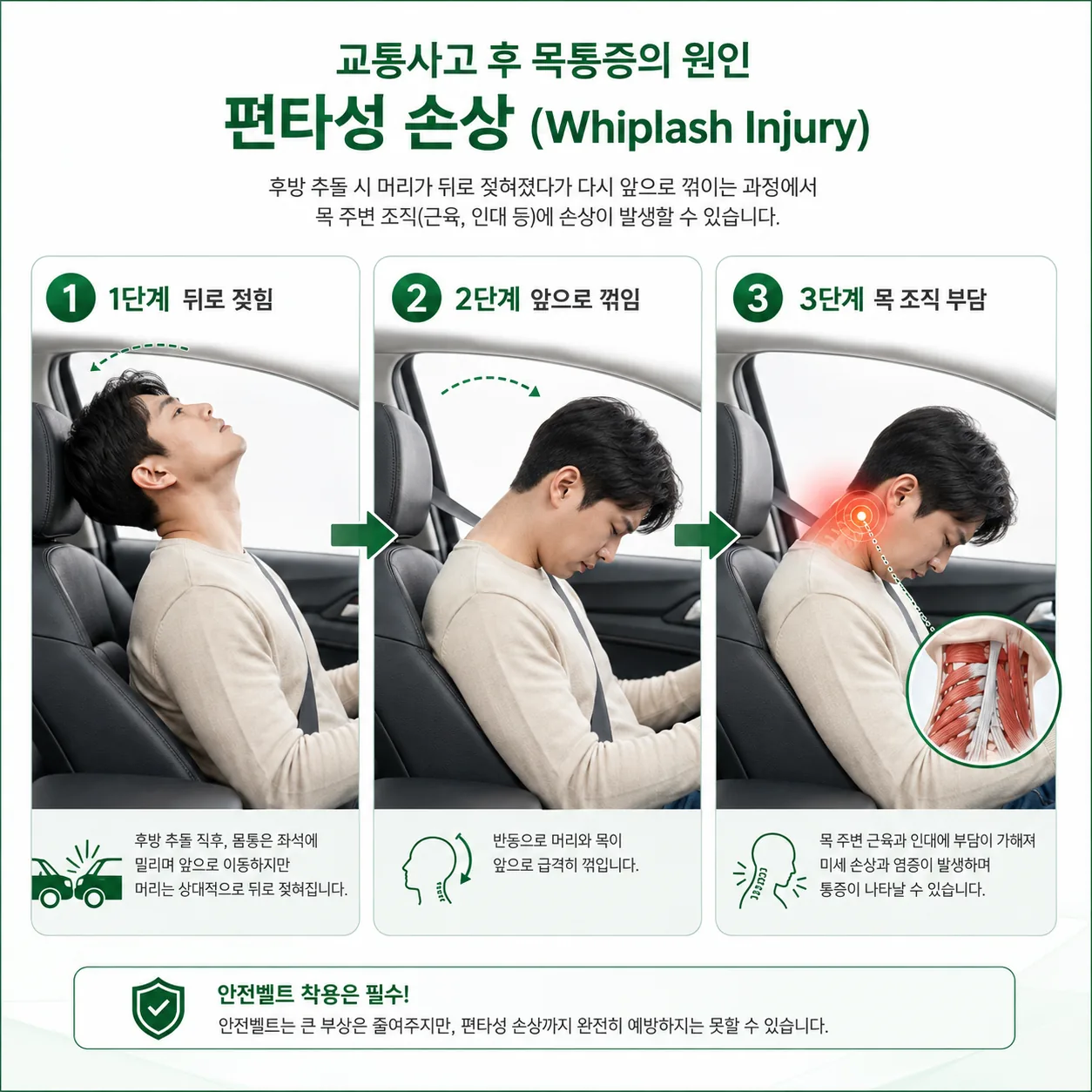 교통사고 편타성 손상(경추 염좌) 발생 원리 3단계 그림