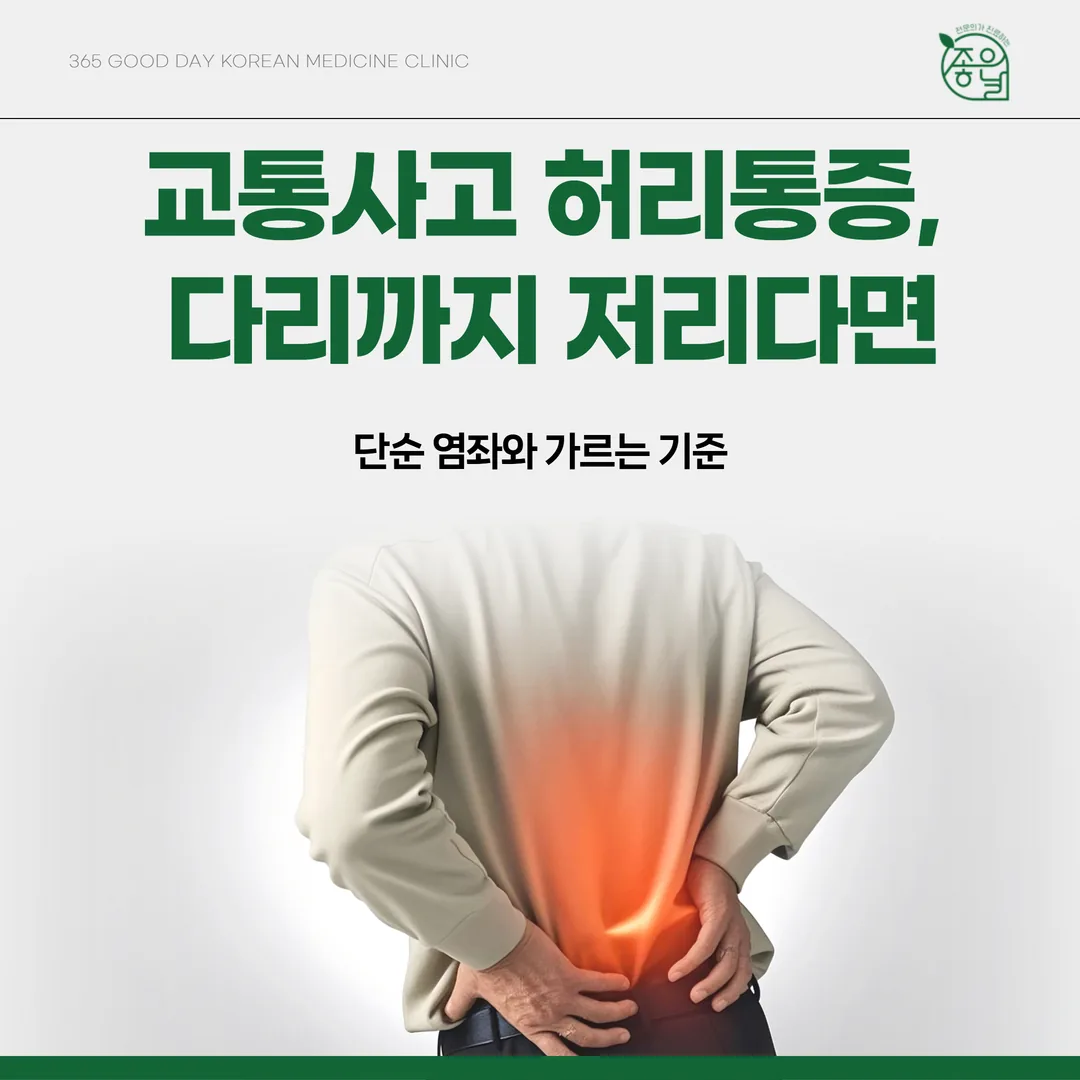 교통사고 허리통증, 다리까지 저리다면 — 단순 염좌와 가르는 기준