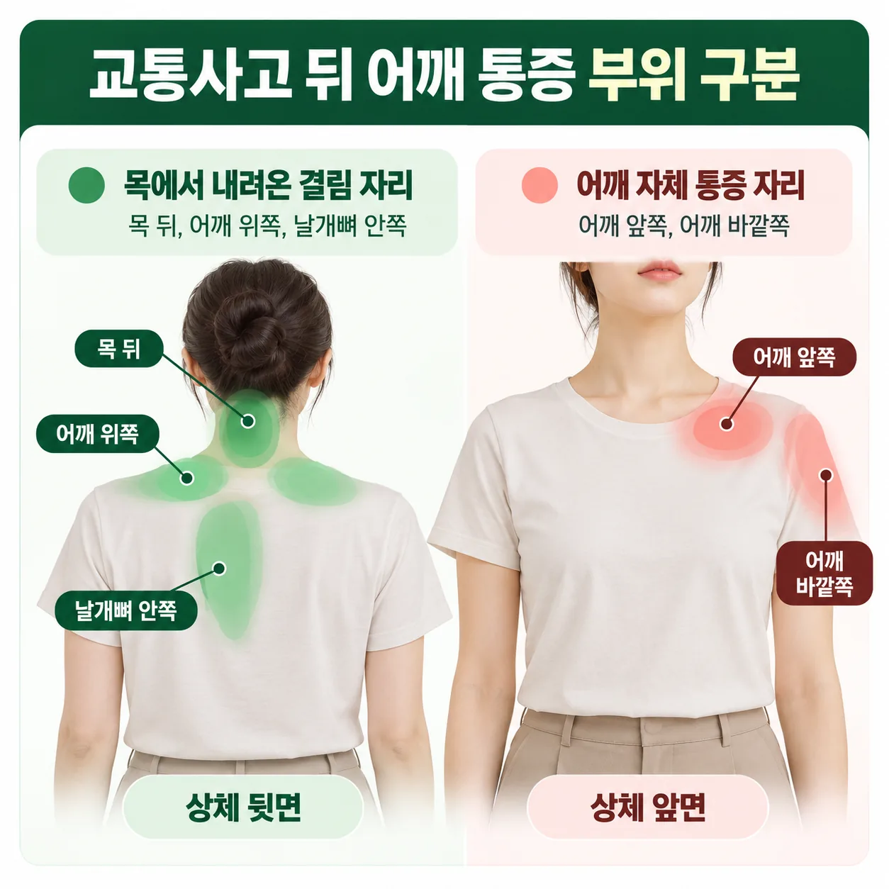 교통사고 뒤 목에서 내려온 결림 자리와 어깨 자체 통증 자리를 색으로 구분한 상체 그림